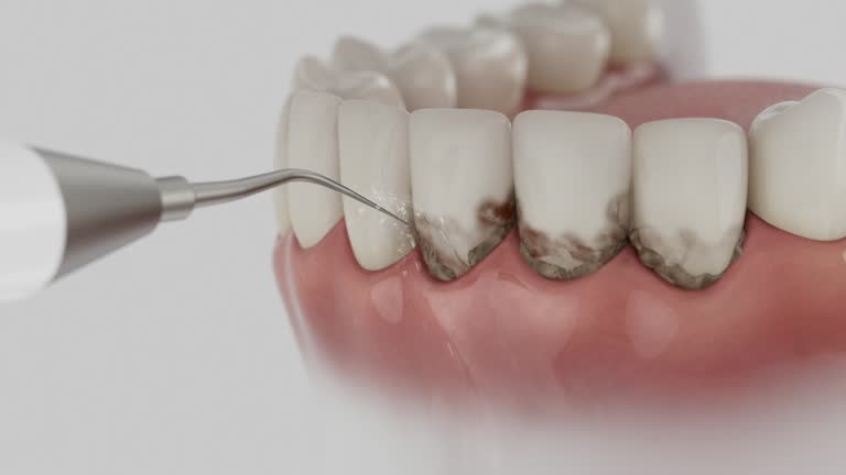 Trusted Dental Crowns And Bridges service in Guin, AL - Dentist Open Now